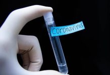 Coronavirus: 84 τα επιβεβαιωμένα κρούσματα στην Ελλάδα