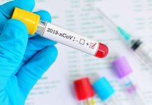 Υποχρεωτικό τεστ για όλους όσοι έρχονται στην Ελλάδα