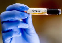 COVID-19: Τουλάχιστον 75.611.670 κρούσματα παγκοσμίως