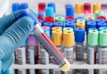 Η πρώτη επίσημη περίπτωση επαναμόλυνσης – Ερωτηματικά για τα αντισώματα