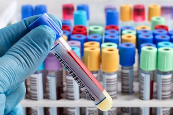 Εκτός ελέγχου η κατάσταση: Νέο ρεκόρ με 935 κρούσματα