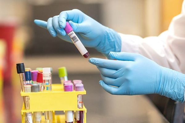 Στην Αττική τα 213 από τα 342 νέα κρούσματα
