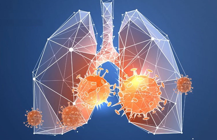 The Covid respiratory trails