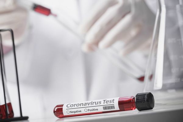Εφιαλτική πρόβλεψη του Αριστοτελείου Πανεπιστημίου για 4.000 κρούσματα την ημέρα στην Ελλάδα