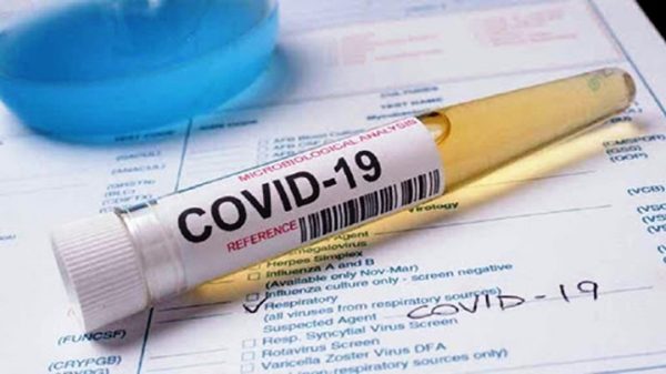 COVID-19: 27.766 νέα κρούσματα 9.971 στην Αττική