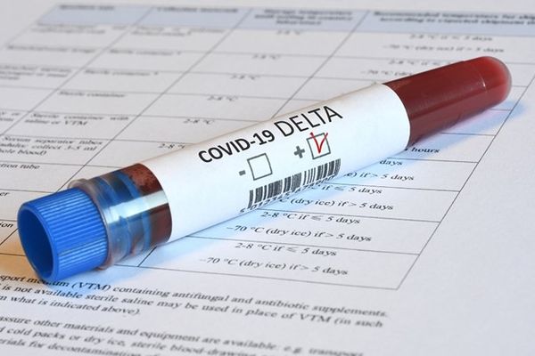 Στο 99,41% η κυριαρχία της μετάλλαξης Δέλτα στην χώρα