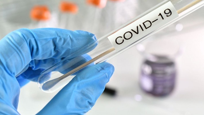 COVID-19: Στα 1.165 τα νέα κρούσματα 31 νεκροί