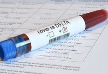 COVID-19: Μείωση κρουσμάτων αλλά πάνω από 90 νεκροί