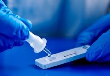 Σε υψηλά επίπεδα τα κρούσματα – Αγωνία για το επόμενο διάστημα
